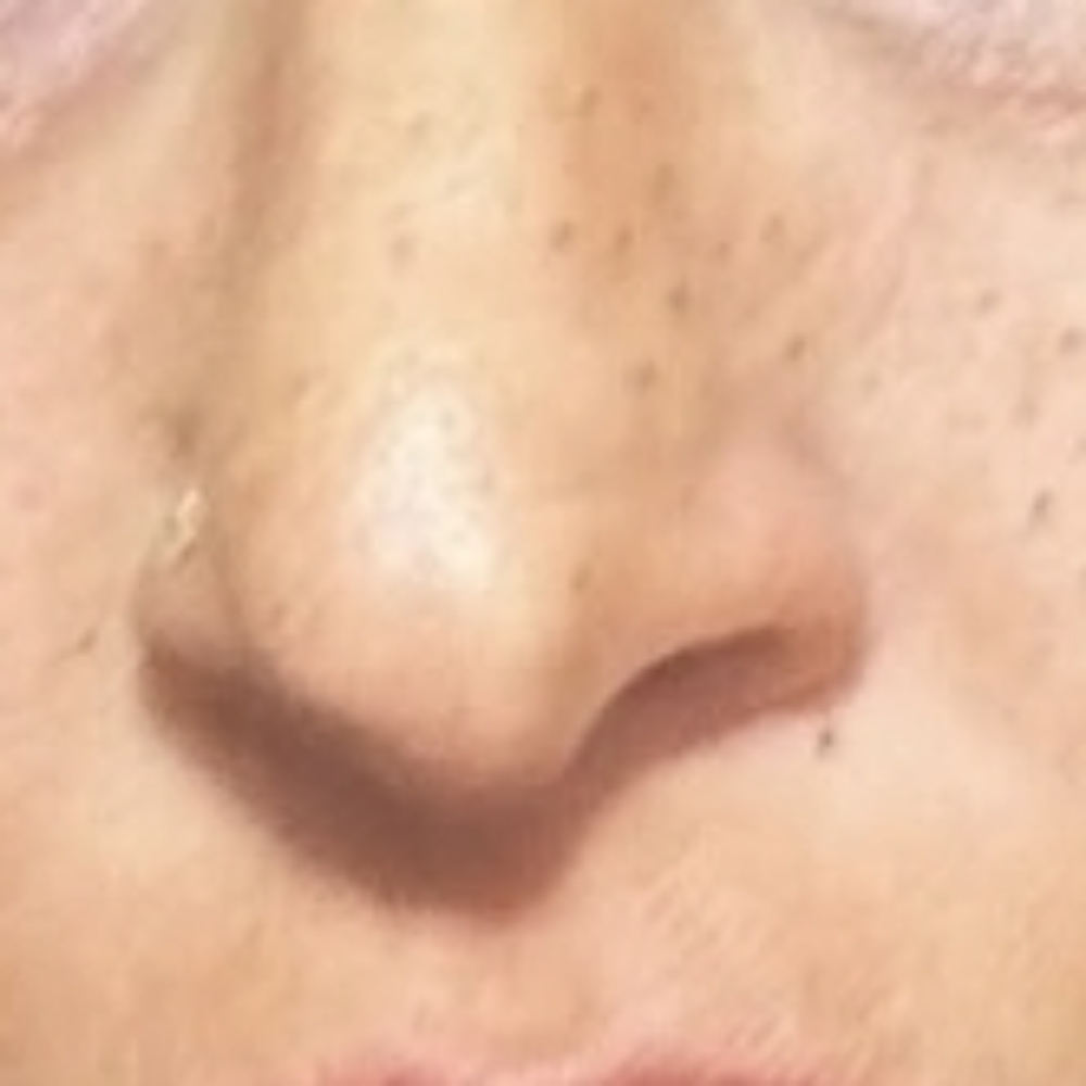 PMU Freckles & Beauty Marks at Carole's Cosmetic Tattoo in Beaverton, OR