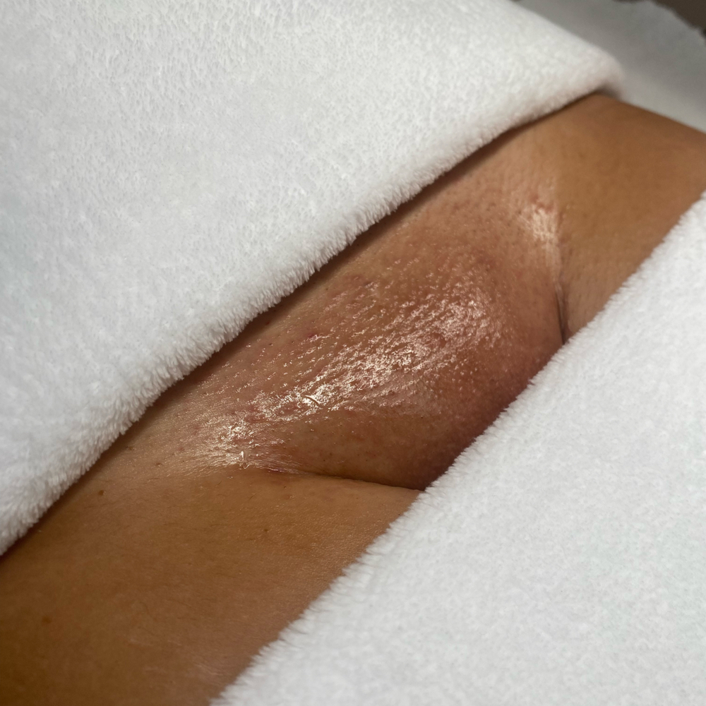 Brazilian Wax