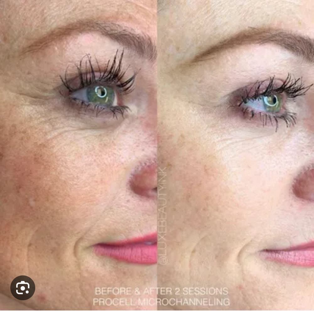 ProCell MD Stem Cell Buy4Get 1 free