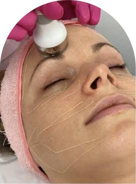 Retinol+Collagen Thread Treatment