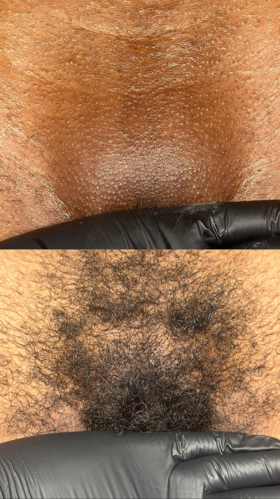 Brazilian Wax