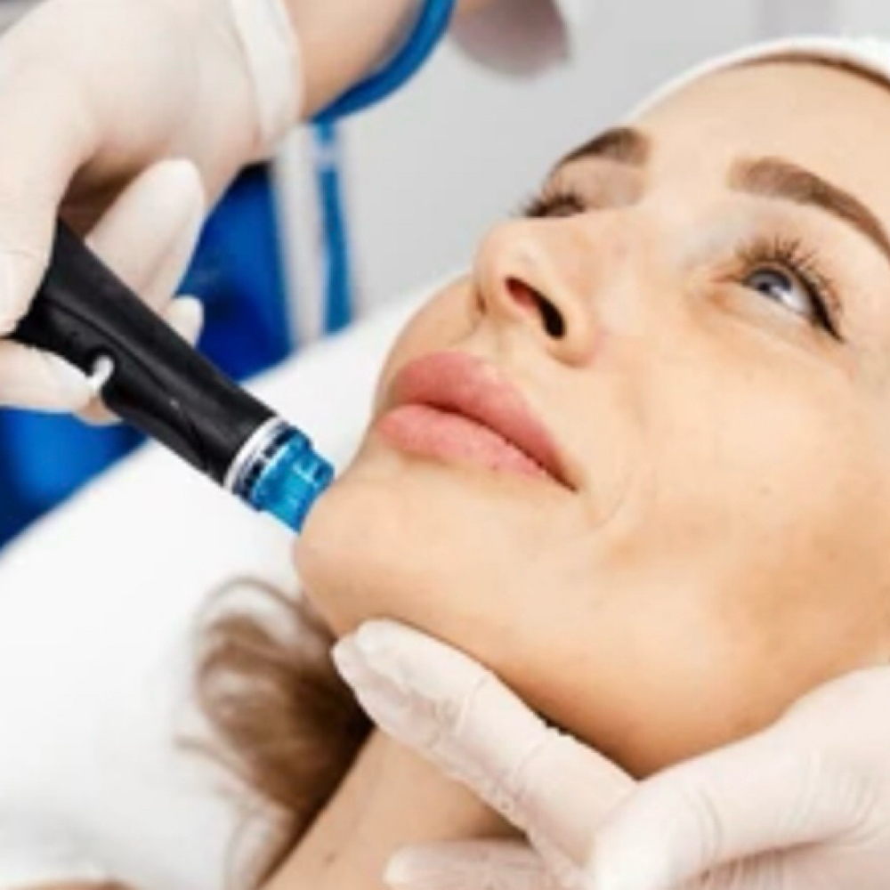 Hydro Facial at Faces by Maryanna