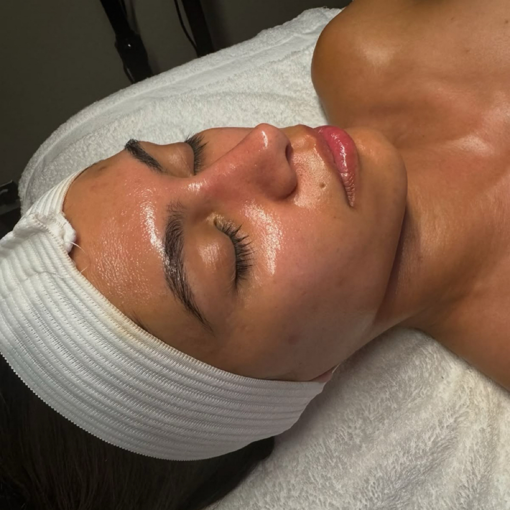 Chemical Peel Facial at Luminous Complexions Esthetics in Oswego, IL