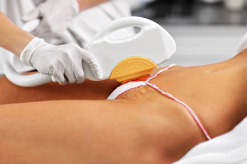 Brazilian Hair Removal (single)
