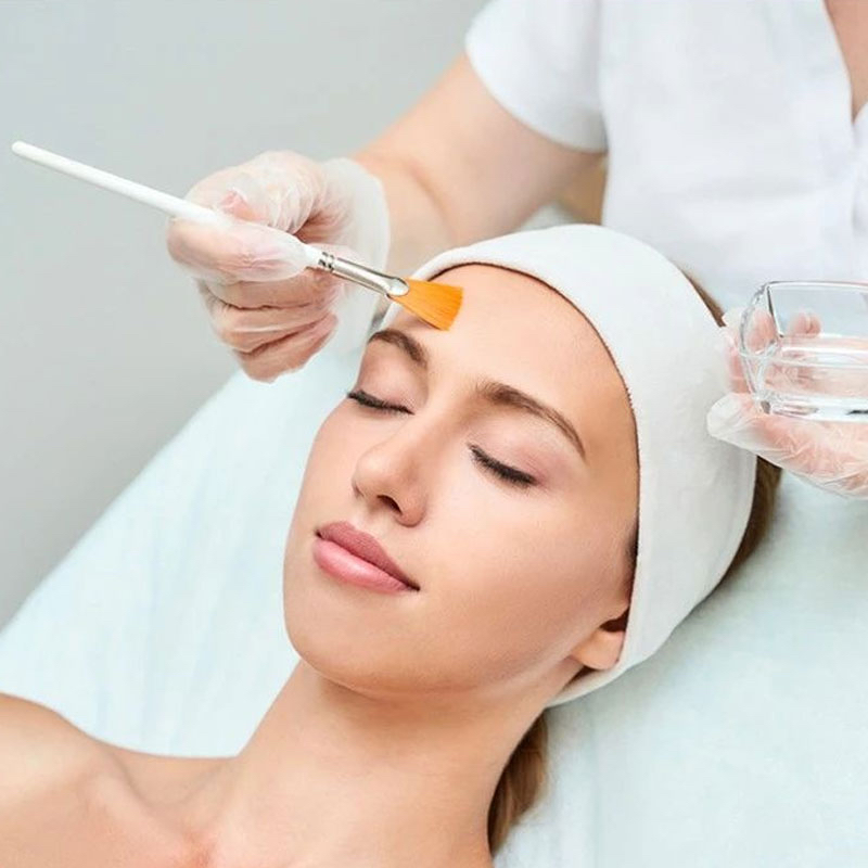 Chemical Peel