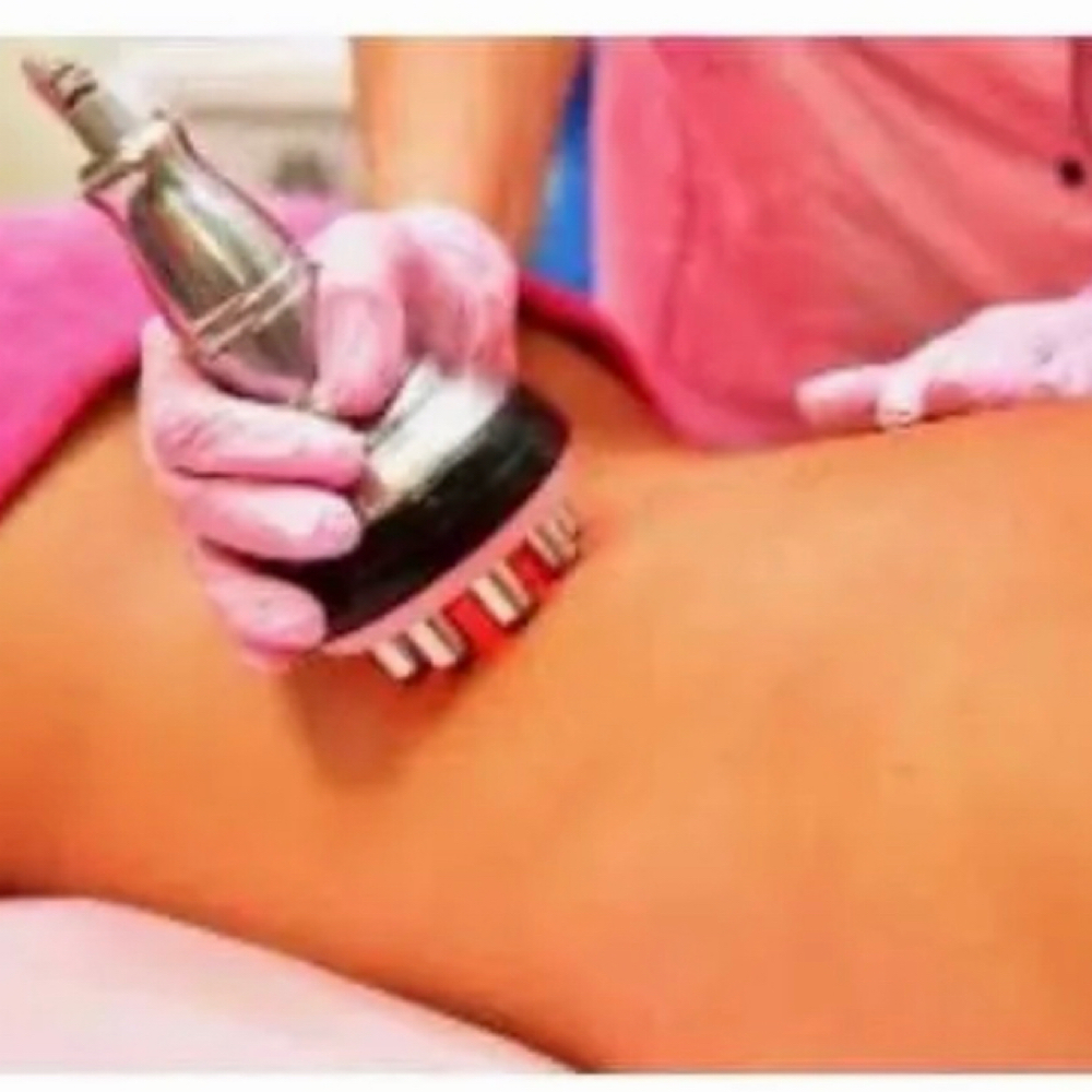 RF Skin Tightening at Ayona’s Medspa and Beauty Bar in Newnan, GA