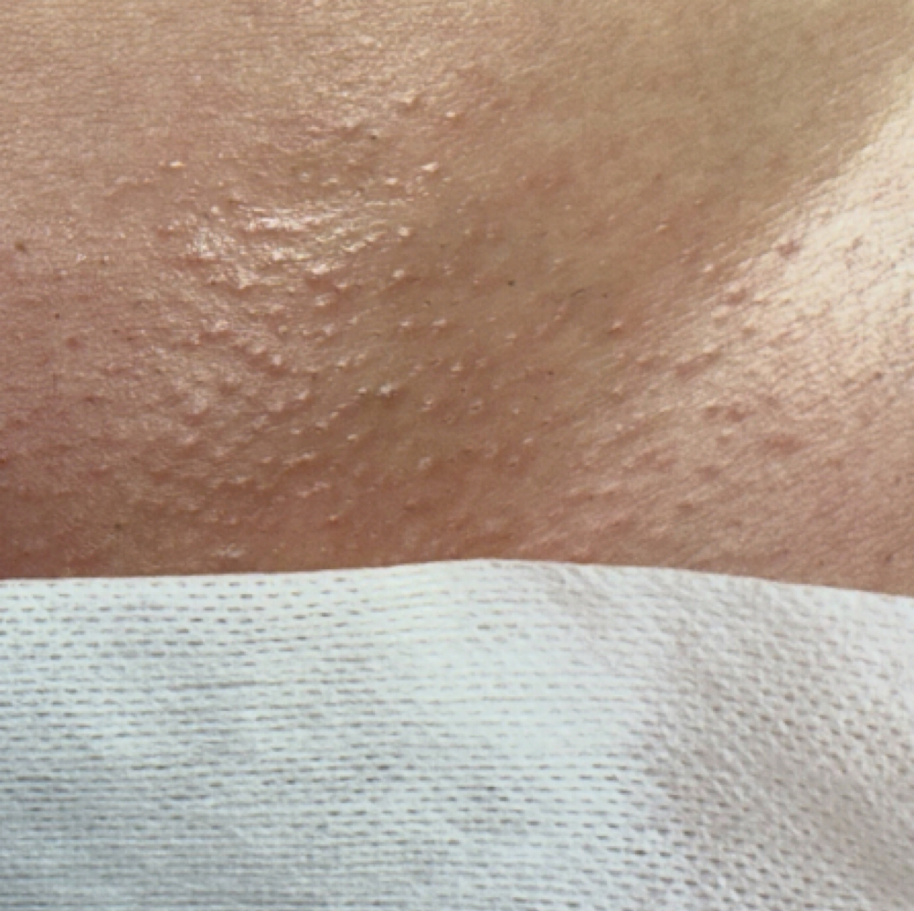 Brazilian Wax *$50 SPECIAL 5/1-5/31 at estheticsbyhan in Eugene, OR