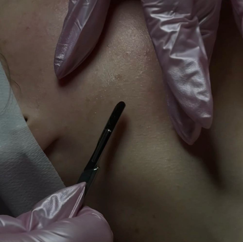 Dermaplane (Facial Add-On) at Skin Harmony Esthetics llc in Allegan, MI