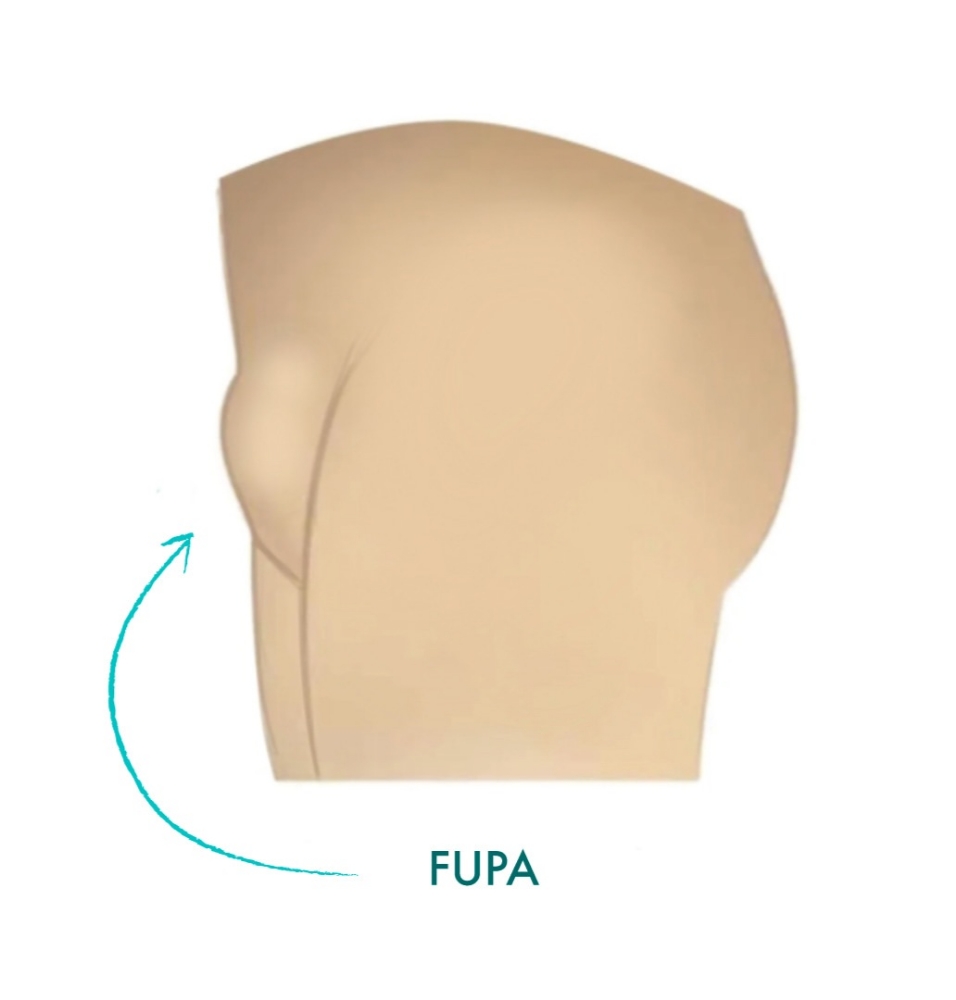 Fupa Reduction