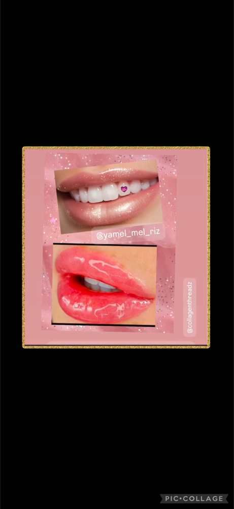 Tooth GeMs 💎