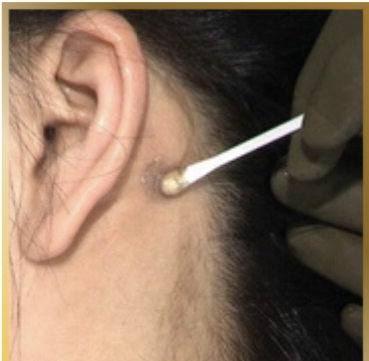 Glue & Tint Patch Test