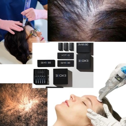 HAIR RESTORATION +AFTERCARE at WilKay Wellness & Aesthetics in Gilbert, AZ