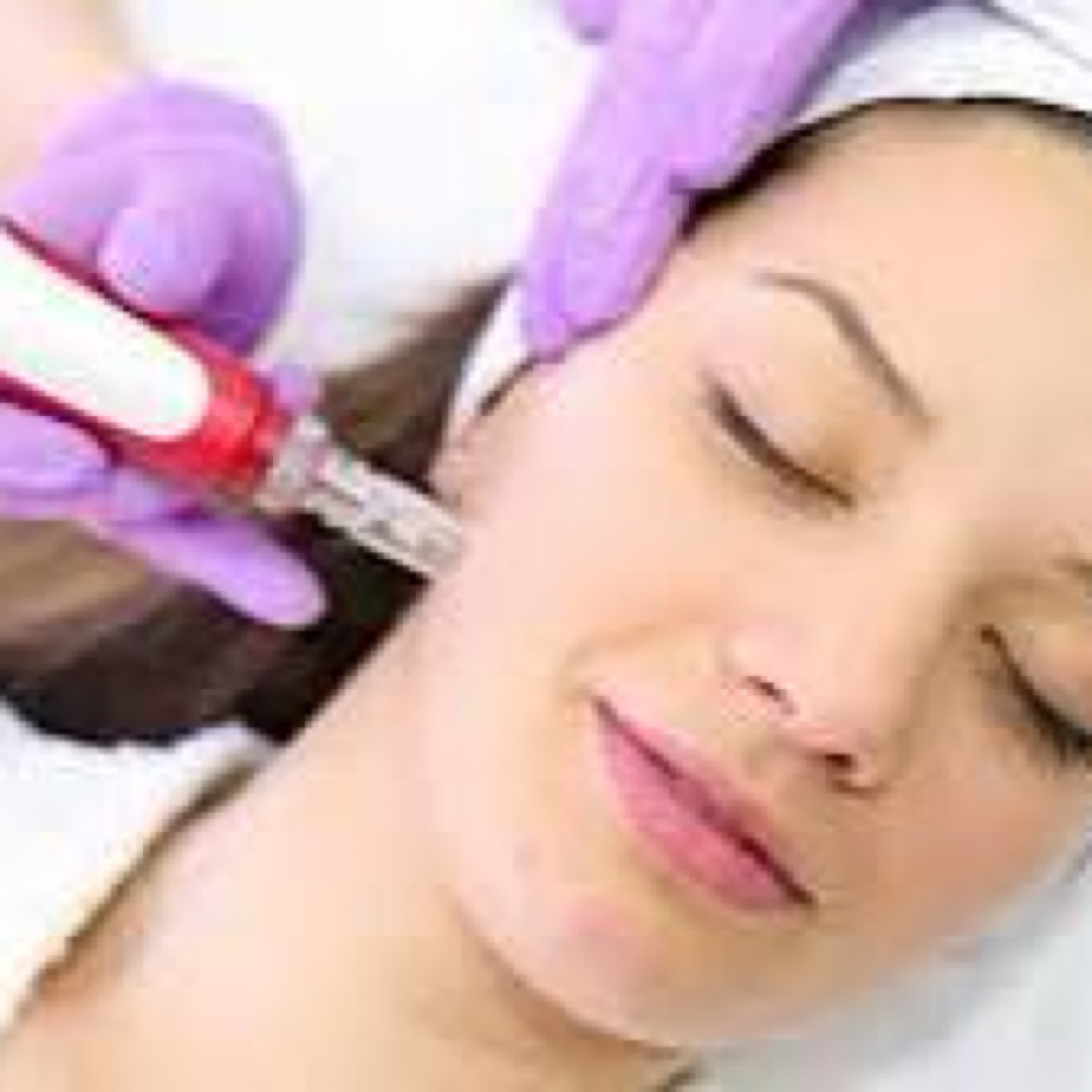 Microneedling Collagen Facial at Alchemy Skin Lab in Tualatin, OR