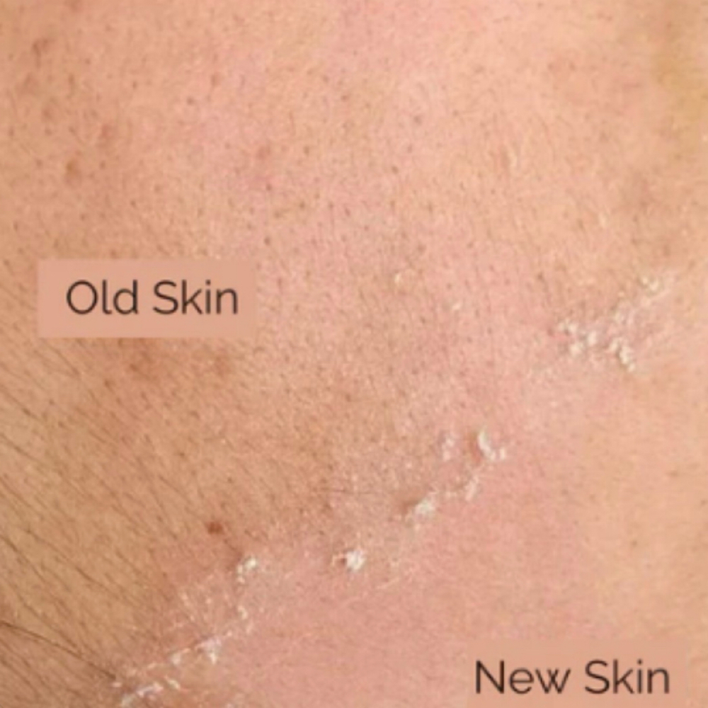 Express Dermaplane Facial at Bloom Esthetics in Oconto, WI