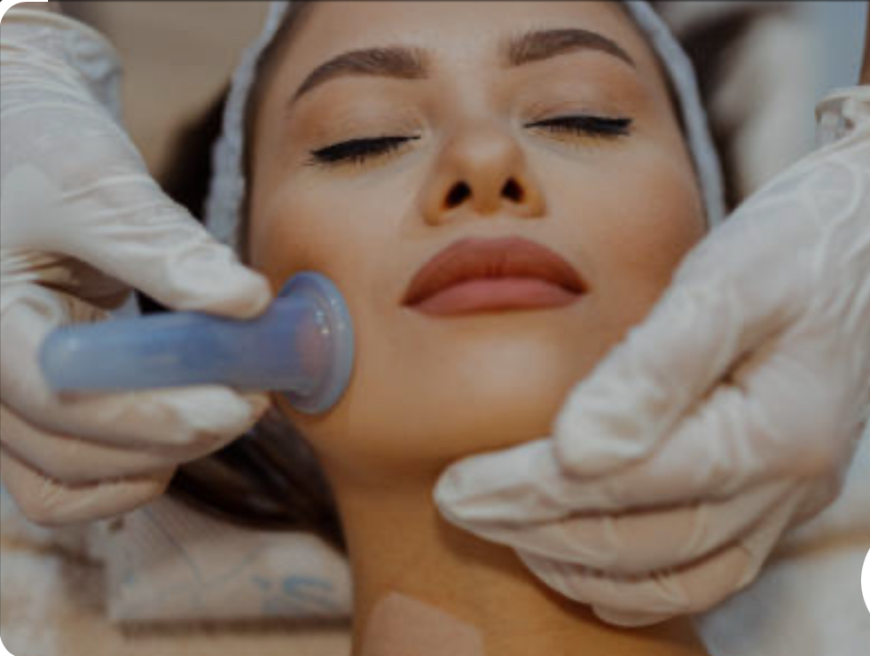 Facial Cupping Add On