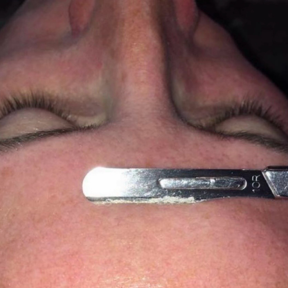 Dermaplaning at Estética Day Spa in SAN Antonio, TX
