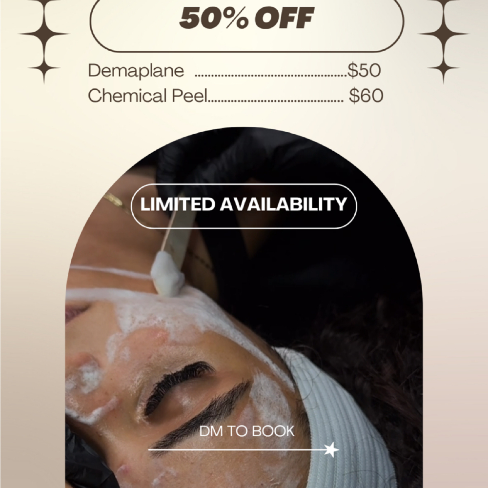 Chemical Peel Sale at PIXIE GLOW ESTHETICS in Hillside, NJ
