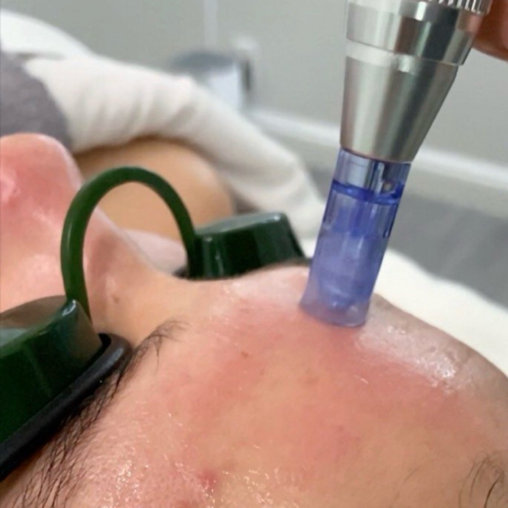 Boost Collagen Treatment at Aesthetics by Makinlee in Pahrump, NV