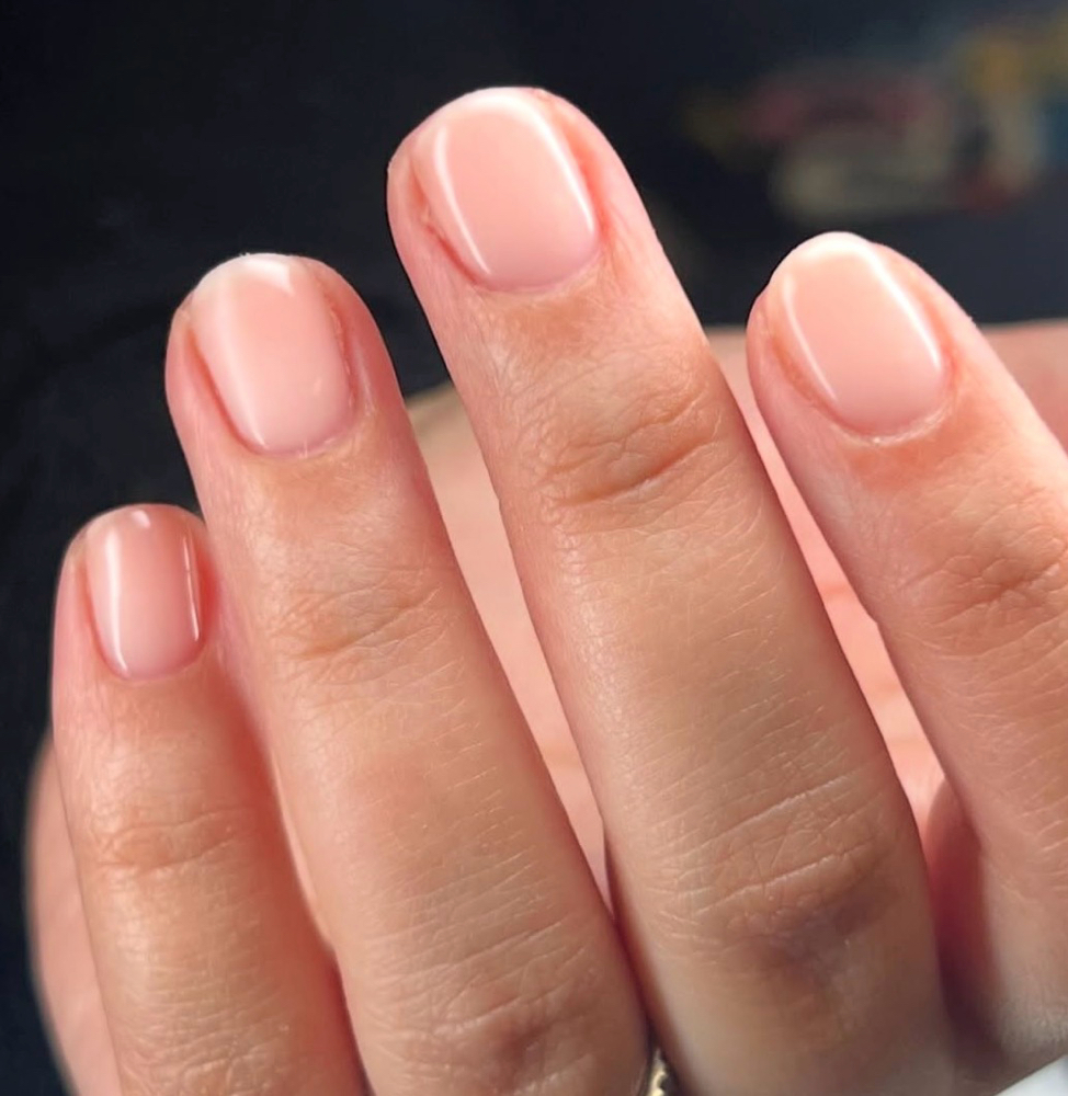 Structured Gel