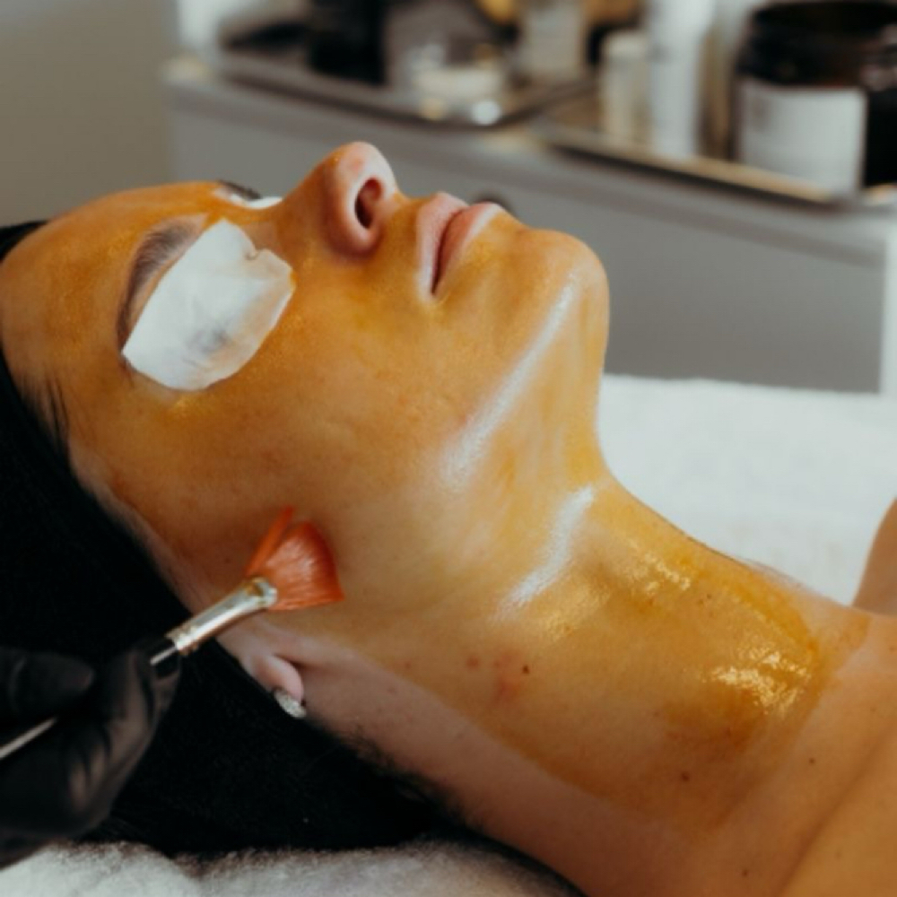 Vi Peel at Aurora Glow Aesthetics in Spring, TX