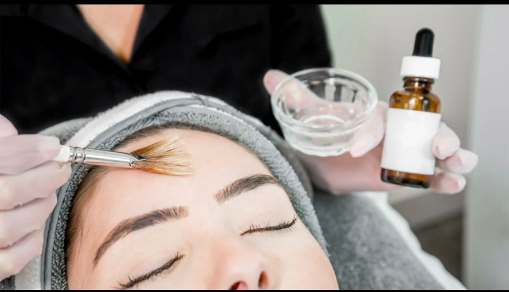 Chemical Peels at Aurora Glow Aesthetics in Spring, TX