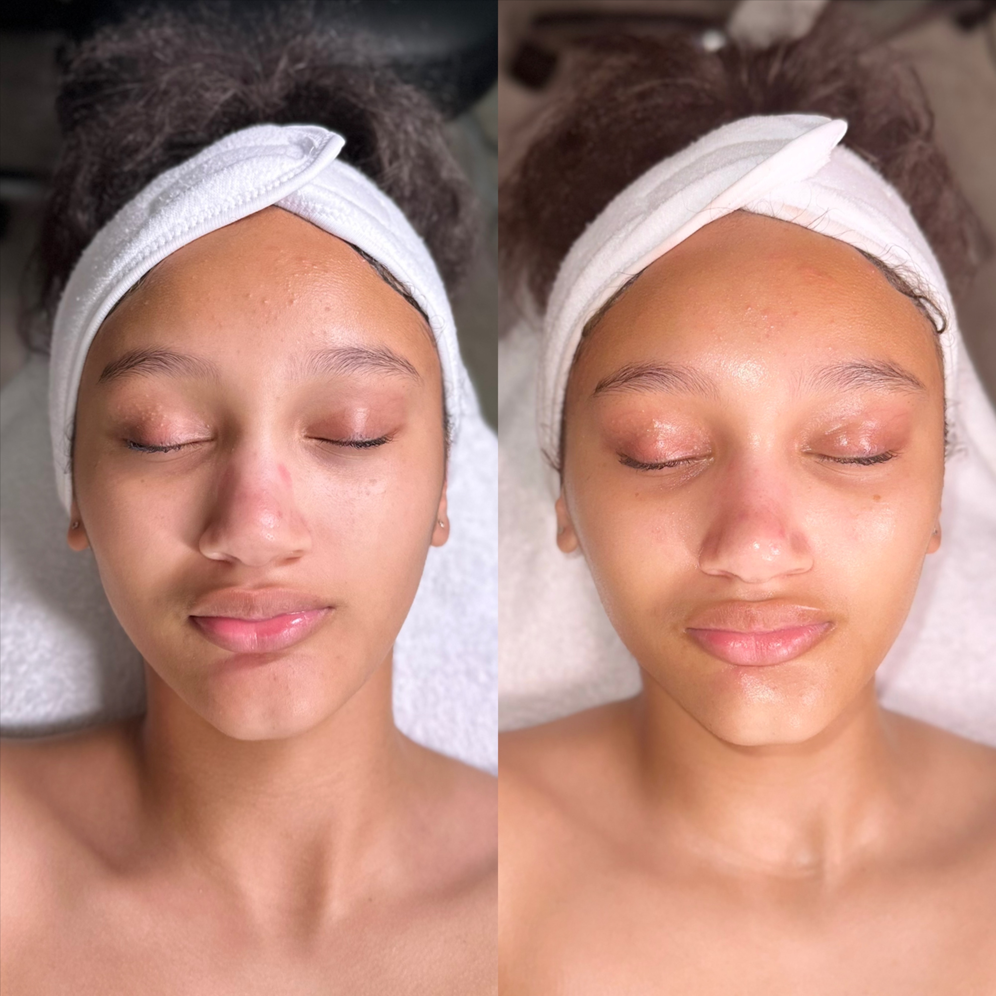 Teen Facial at Jewels Beauty in Fairview, NJ