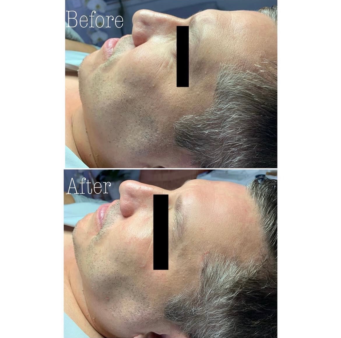 The Anti-aging Facial