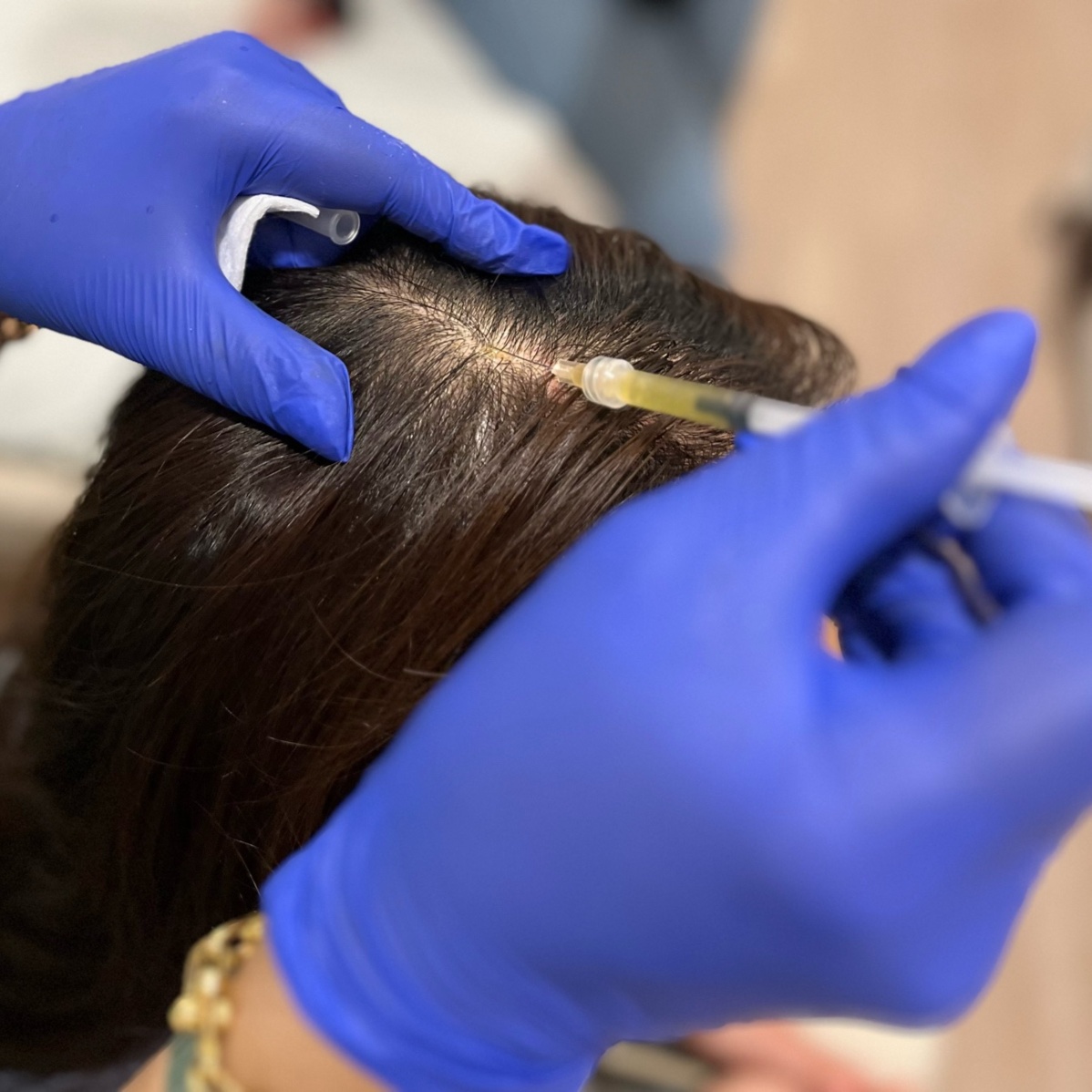 Hair Restoration at The Beauty ER in Webster, MA