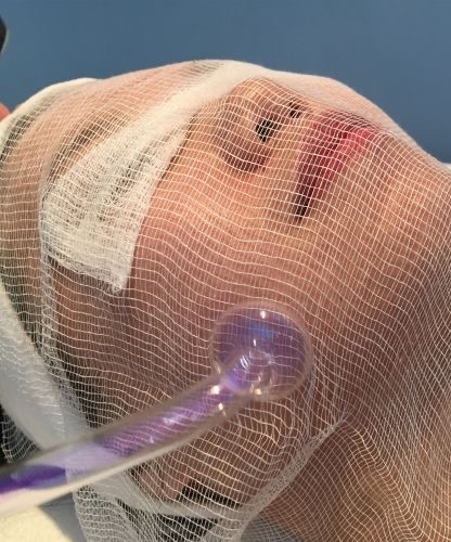 Luxe Facial at Crave Luxe Skin & Ink Spa in Roseville, MI