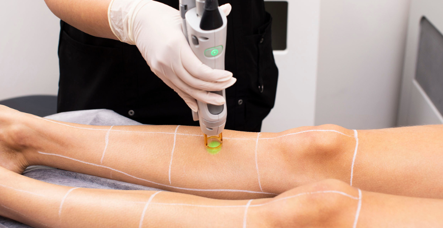 Laser Hair Removal (Half Leg)