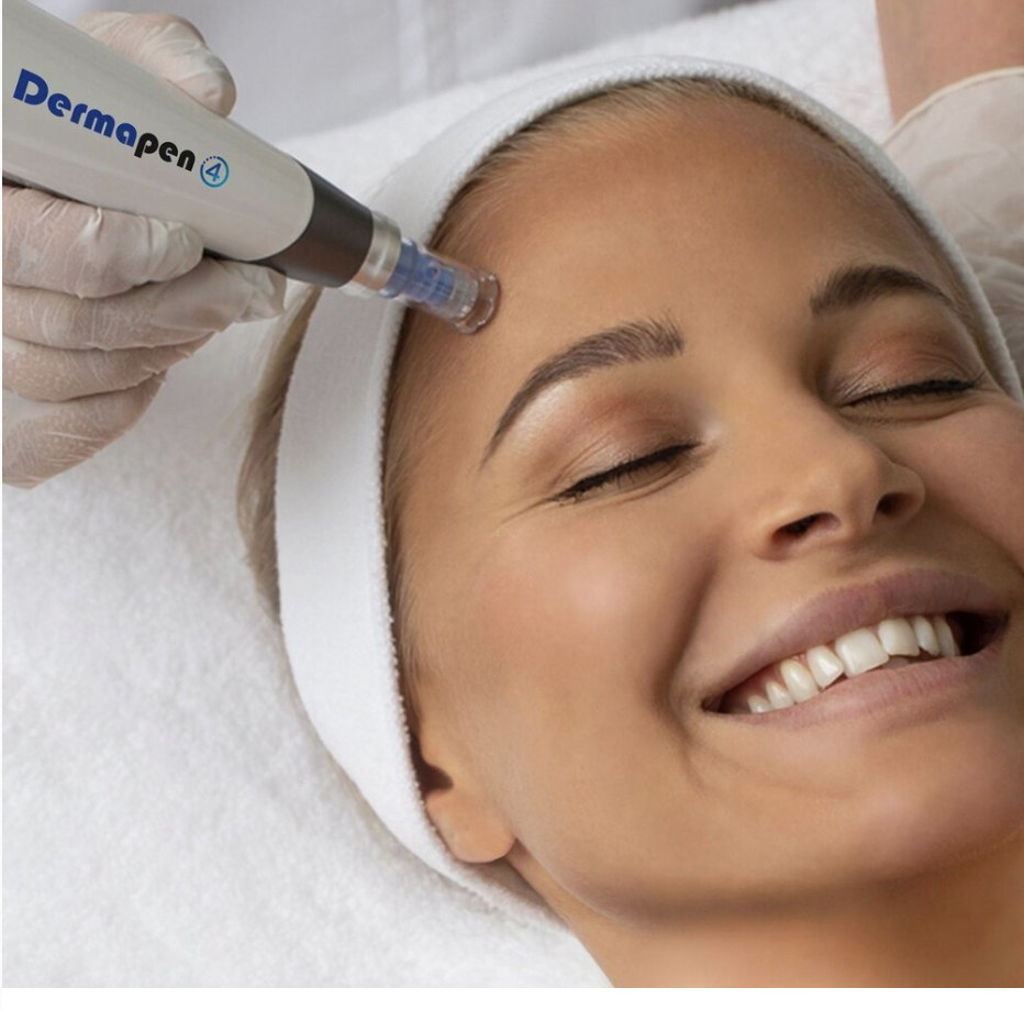 Microneedling