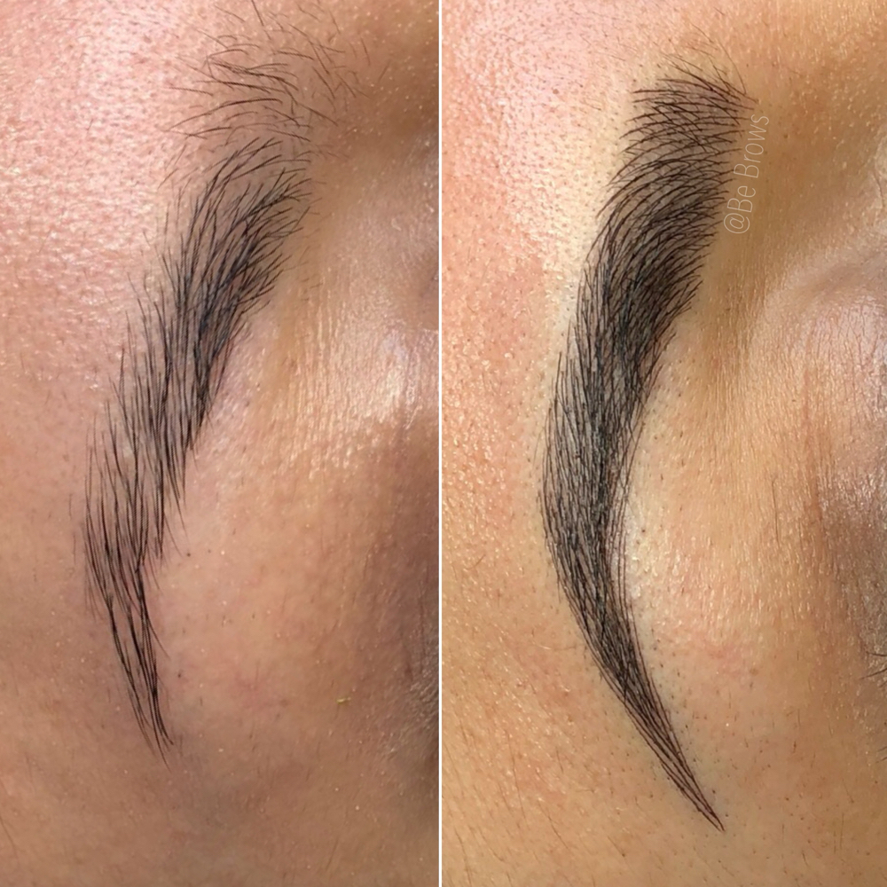 👉Touch Up(Existing Clients Only) at Aura Aesthetics spa in Houston, TX