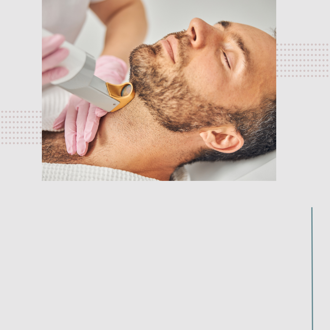 Laser Hair Removal - Beard