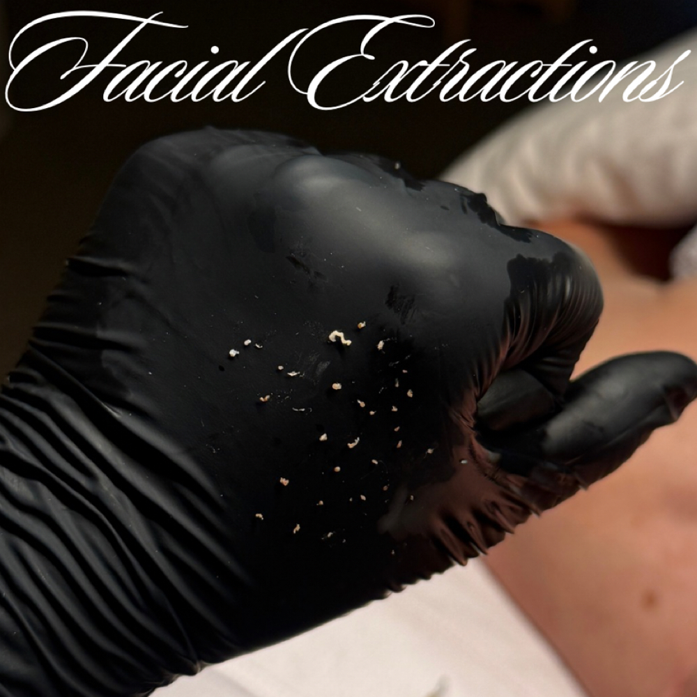 Extraction Add On at Lux South Med Spa in Glennville, GA