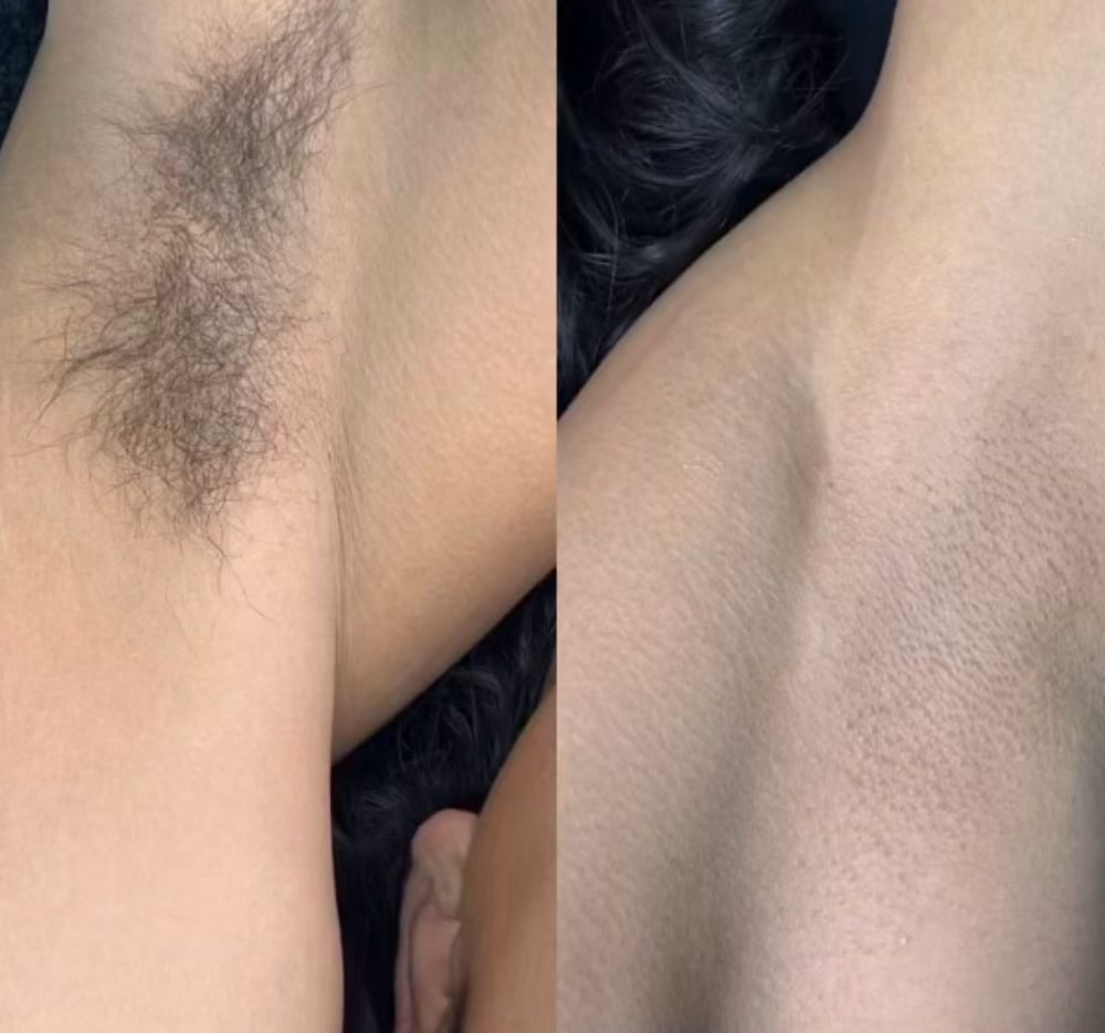 under arm wax