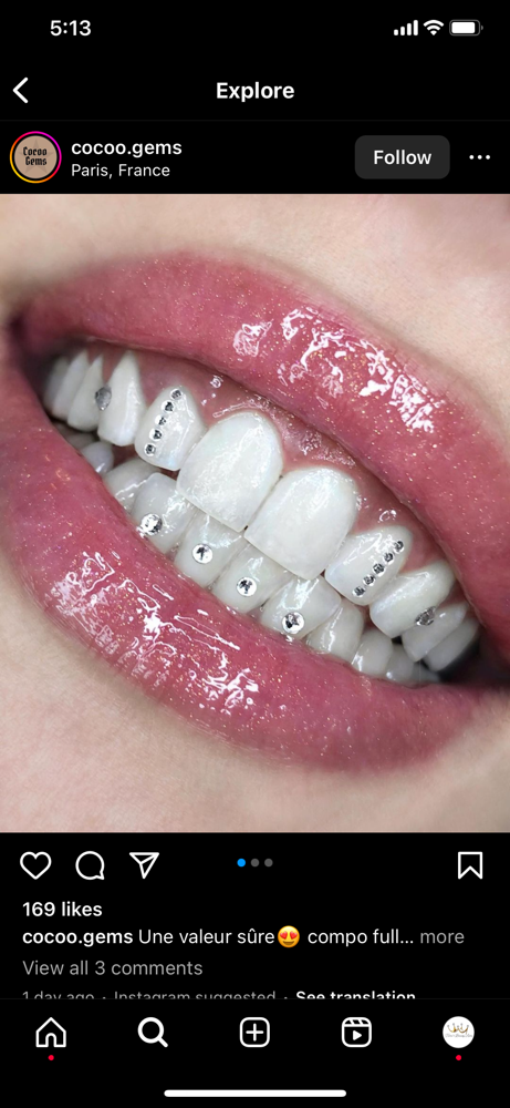 Teeth whitening & Tooth gems