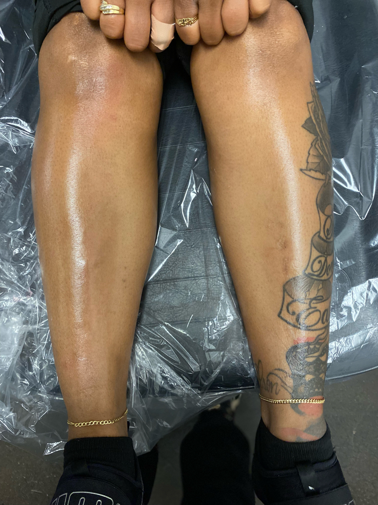 Full Leg