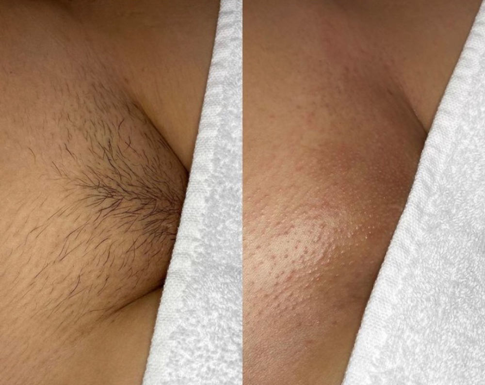 Bare Bliss Brazilian