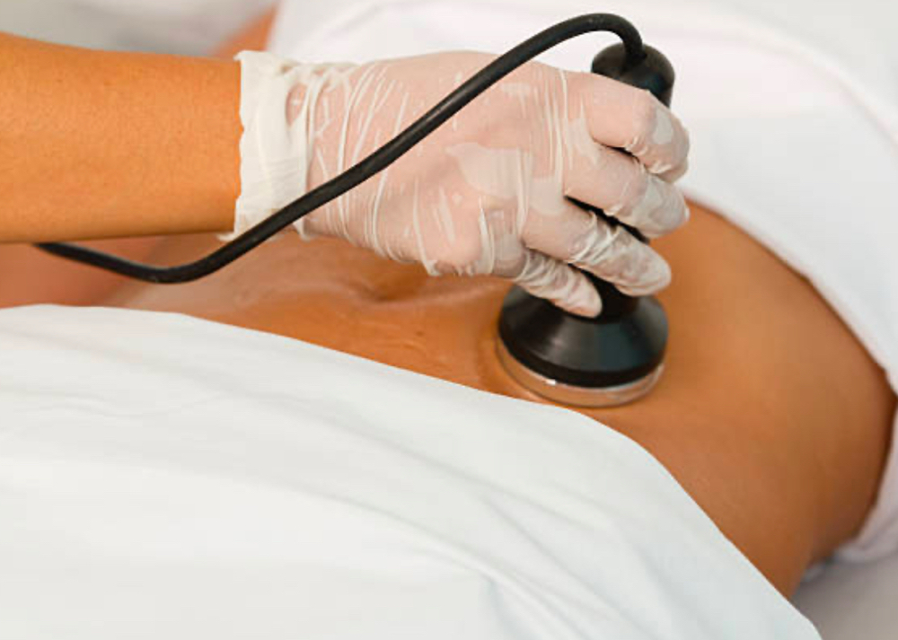 Tummy Cavitation 10 Visits