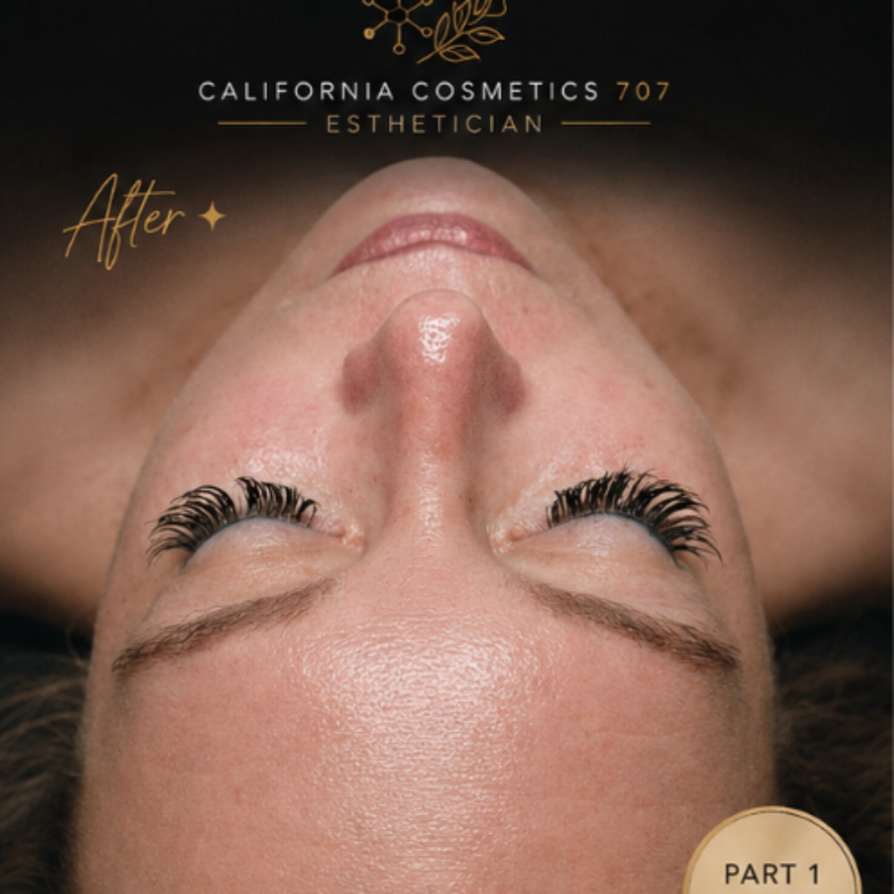 Chemical Peel + Nano Channeling at California Cosmetics 707 in Mckinleyville, CA
