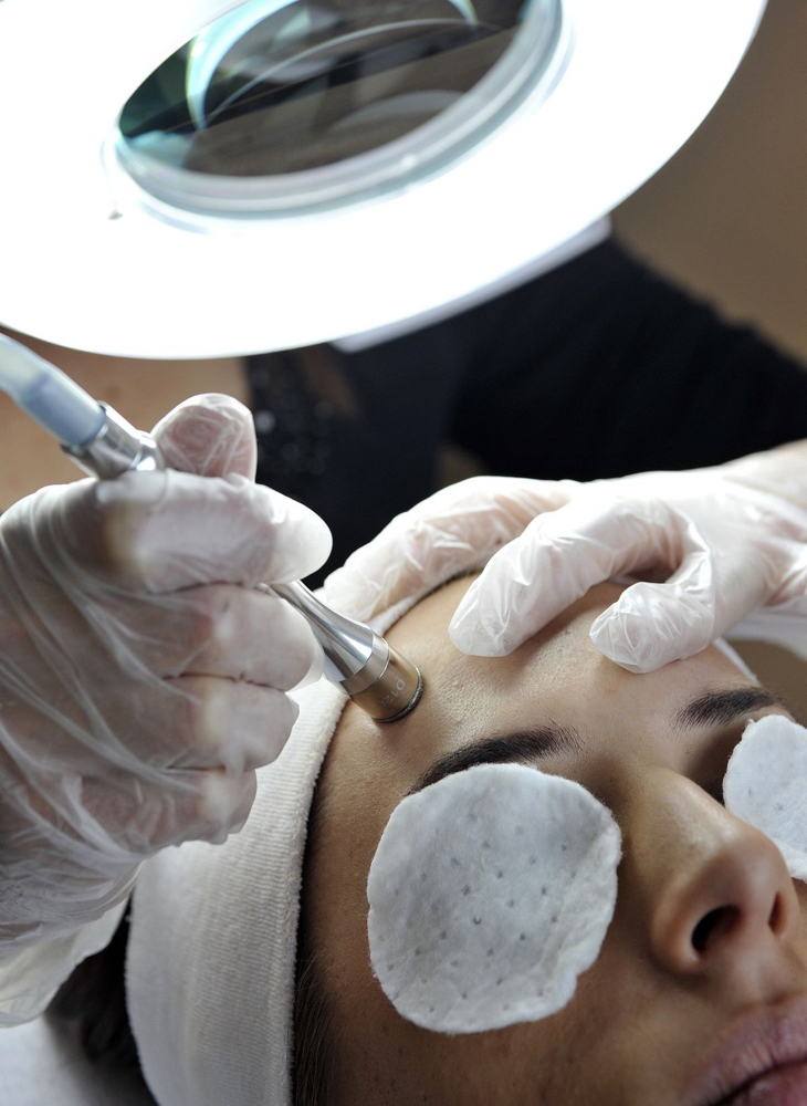 Add On/ Microdermabrasion