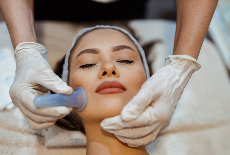 Facial Cupping at River & Clay Esthetics in Agawam, MA