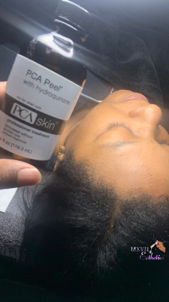 PCA Peel w/ Hydroquinone