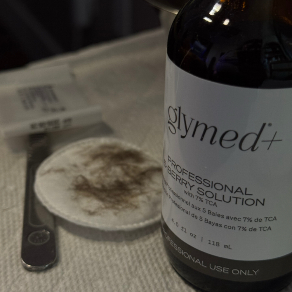 Chemical Peel at Xitlaly, Licensed Esthetician & Makeup Artist in Richland, WA