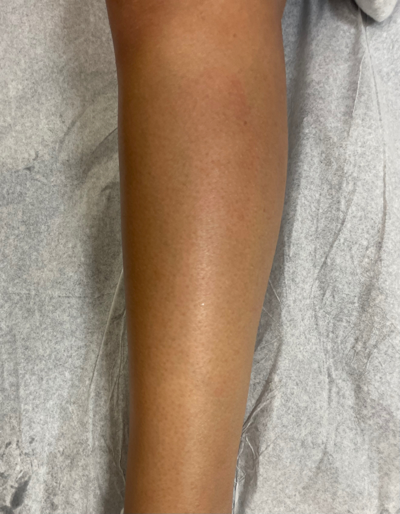 Full Leg Wax