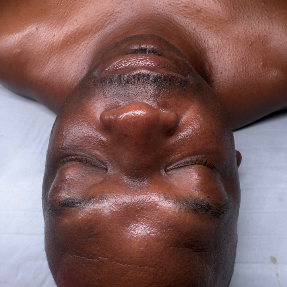Skin Clarity Consultation at The Glitz Skin Studio in San Antonio, TX