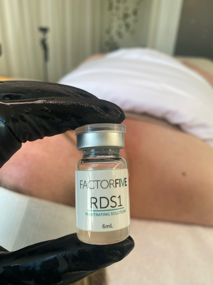 FactorFive Peel W/ Microneedling