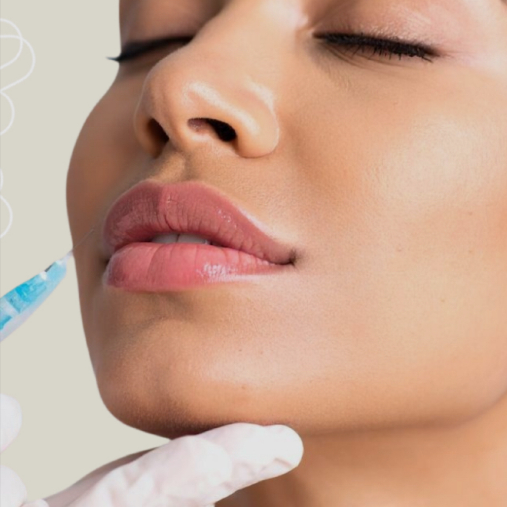 Dermal Filler Consultation