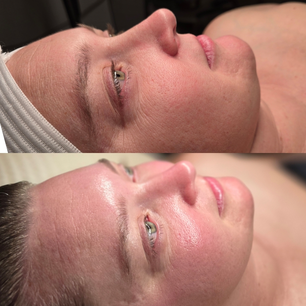 New Client Facial + Consult at Oregon Glow in Junction City, OR