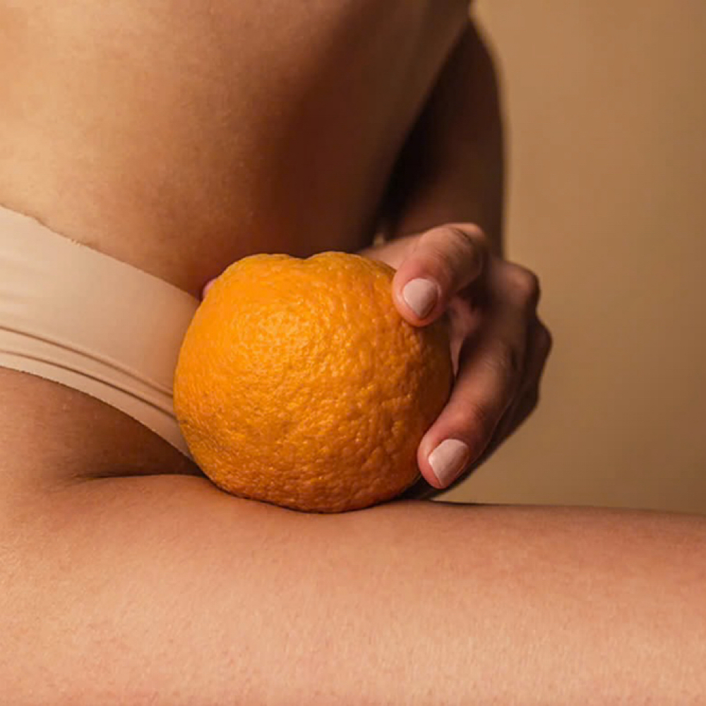CELLULITE REDUCTION at Sculpt ME in Longview, TX